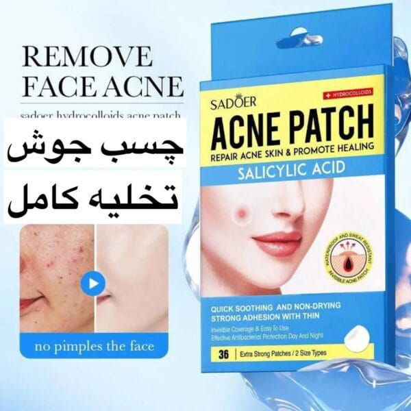 چسب جوش